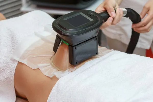 Image of person having fat freezing treatment to help weight gain Malvern Link
