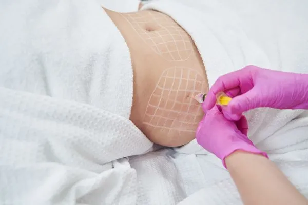 image of fat dissolving injections on love handles to help combat weight gain Malvern Link
