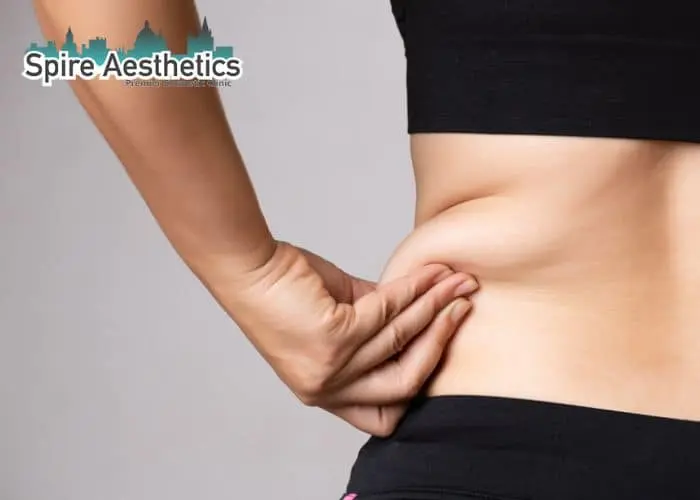 Image of woman pinching fat on their hips Malvern Link. Fat Freezing treatment